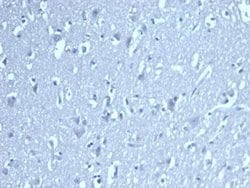 LEF1 Antibody (LEF1/422R) - Azide and BSA Free, Novus Biologicals 100 &mu;g | Buy Online | Novus Biologicals | Fisher Scientific
